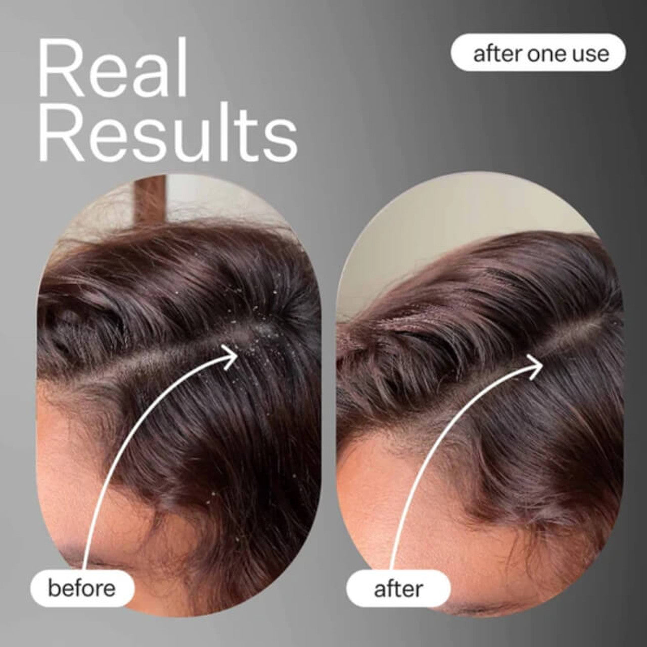 Scalp Detox & Treatment