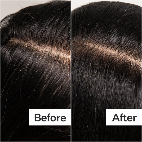 Scalp Detox & Treatment
