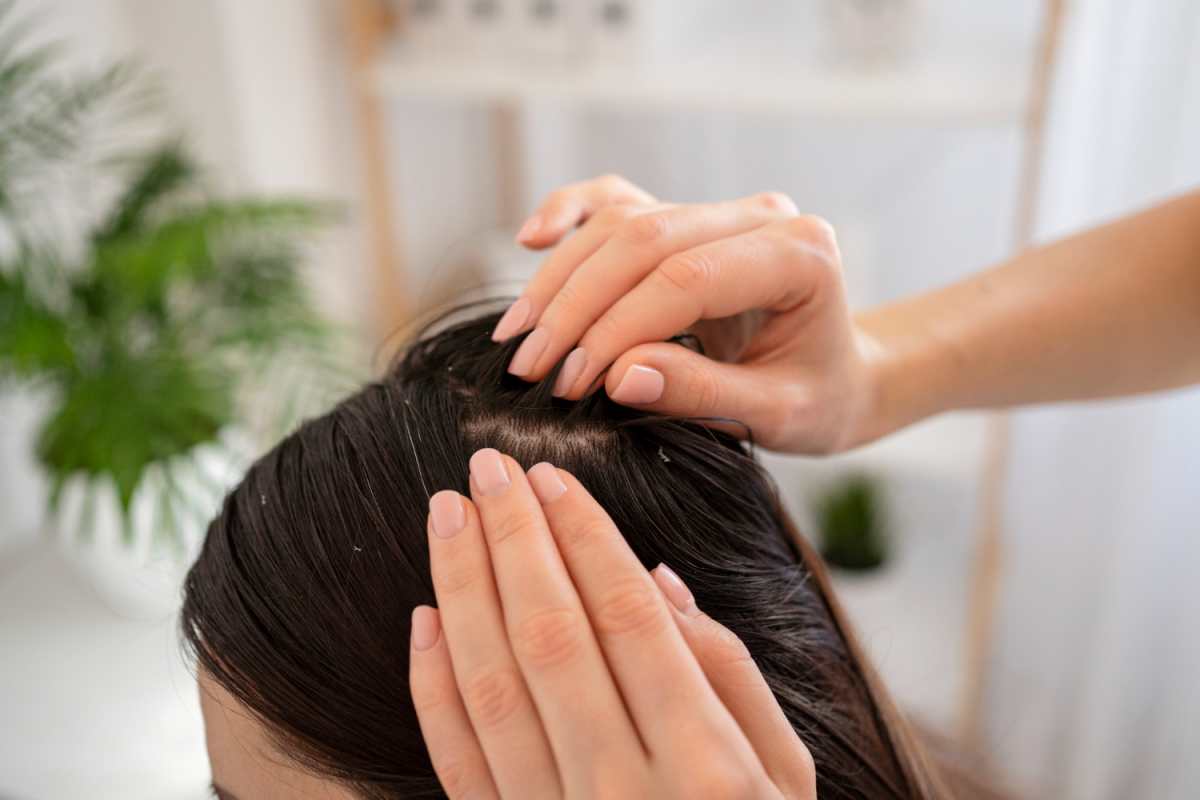 Scalp Treatment