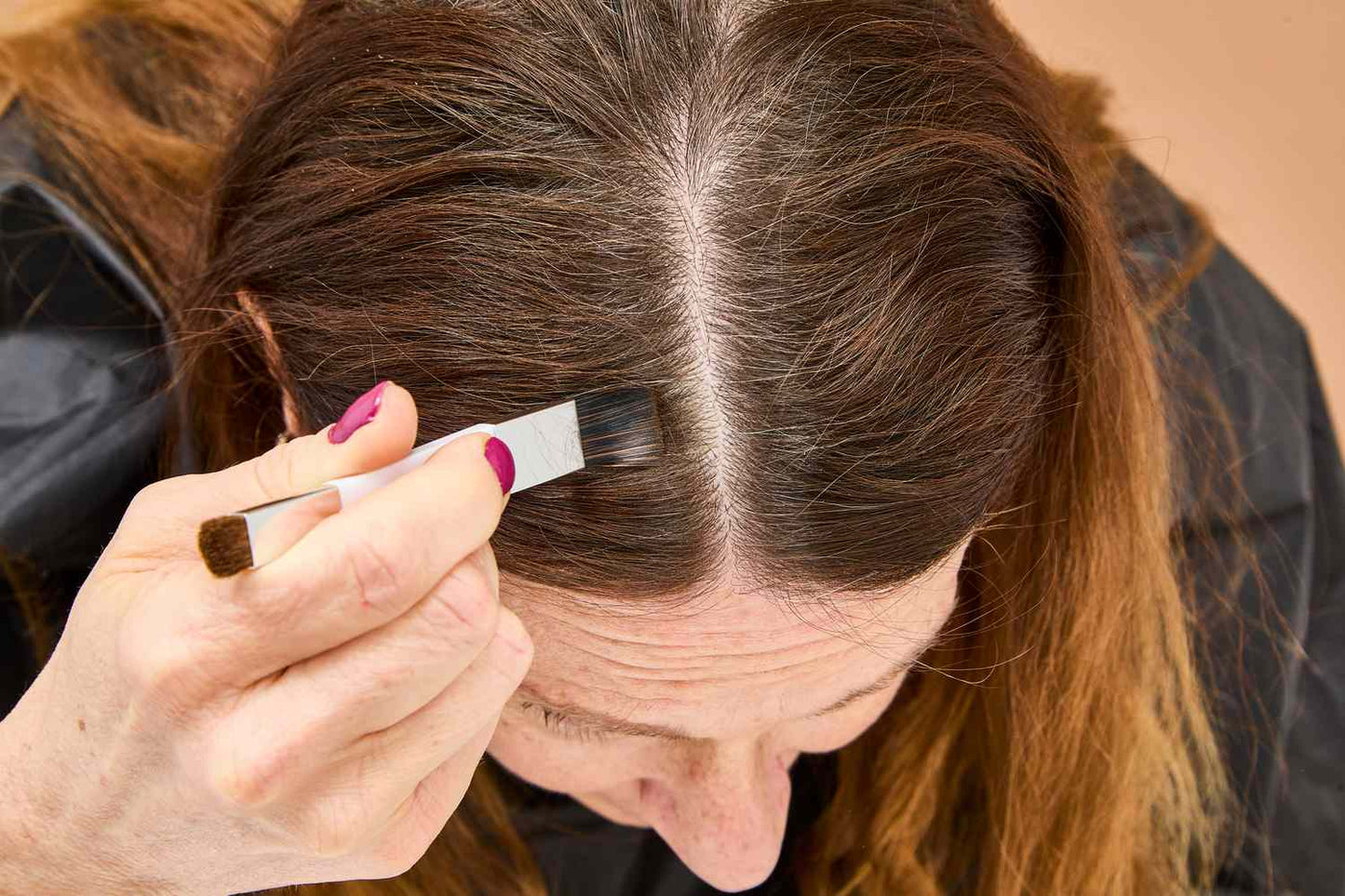 Root Touch-Up